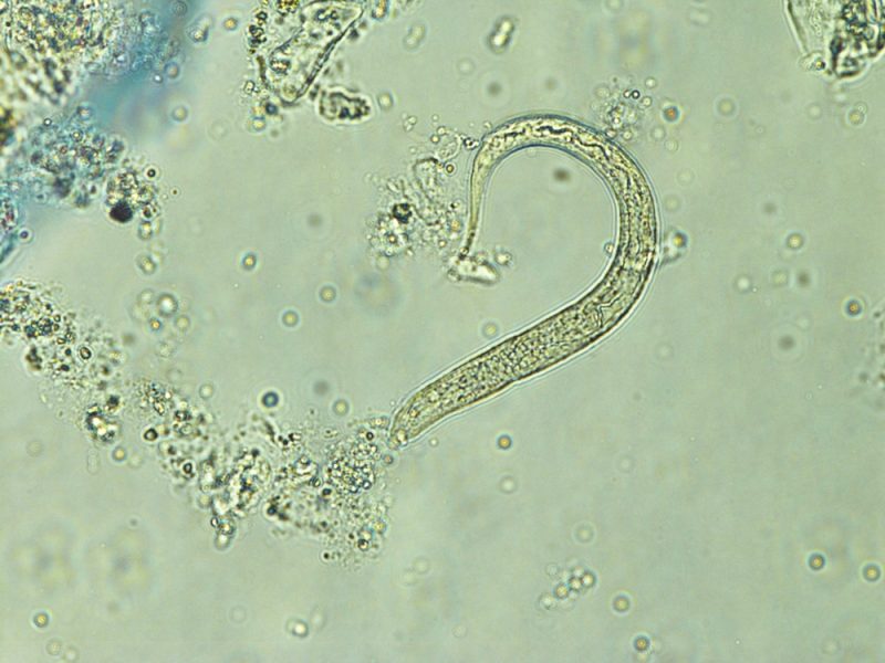 hookworm