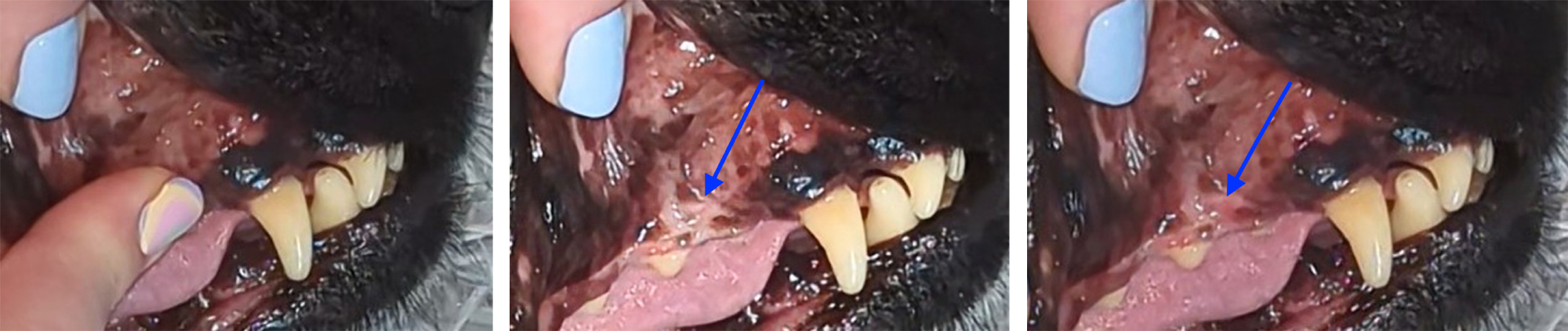 capillary refill time (CRT)